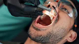 Zahngesundheit – Warum uns Zahnstein nervt – und die Forschung begeistert