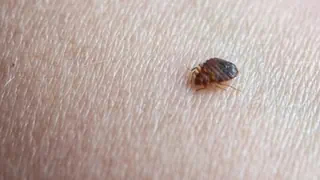 Teure Bettwanzenbekämpfung – Bettwanzen-Notfall: Frau zahlt 6000 Franken – Schädlinge noch da