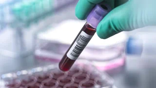 Junges Herz, alte Leber? – Unser Blut verrät unser wahres Alter