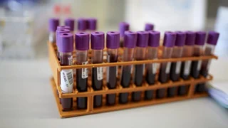 Bluttest statt Untersuchung – Wie umgehen mit neuen Alzheimer-Bluttests?