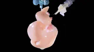 Zu wenig Spenderorgane – Neue Hoffnung: Organe aus dem Labor