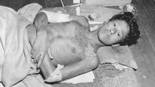 80 Jahre nach dem Atomschlag – Nagasaki: Was bleibt im Körper, der Psyche und der Gesellschaft?