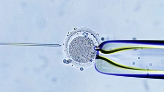 Zwei Mütter, ein Vater – Acht gesunde Babys mit Genen von drei Eltern geboren