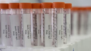 Beeinträchtigung der Umwelt – «Die PFAS haben Zeit, Schäden im Körper anzurichten»