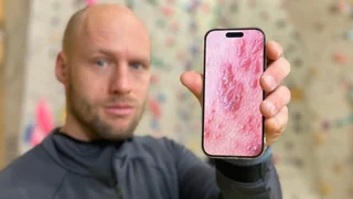 Gürtelrose und Fieberbläschen – Wenn Herpesviren erwachen, beginnt ein Wettlauf gegen die Zeit