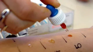 Wenn der Körper überreagiert – Fortschritte in der Allergie-Behandlung