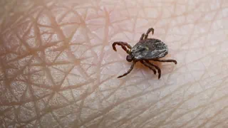 Höchste Fallzahlen seit 2020 – Suva verzeichnet starken Anstieg an Zeckenstichen in der Schweiz