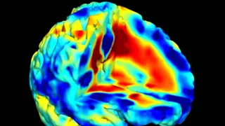 Versuch in Genf – Wie Hightech und KI die Psychiatrie verbessern sollen