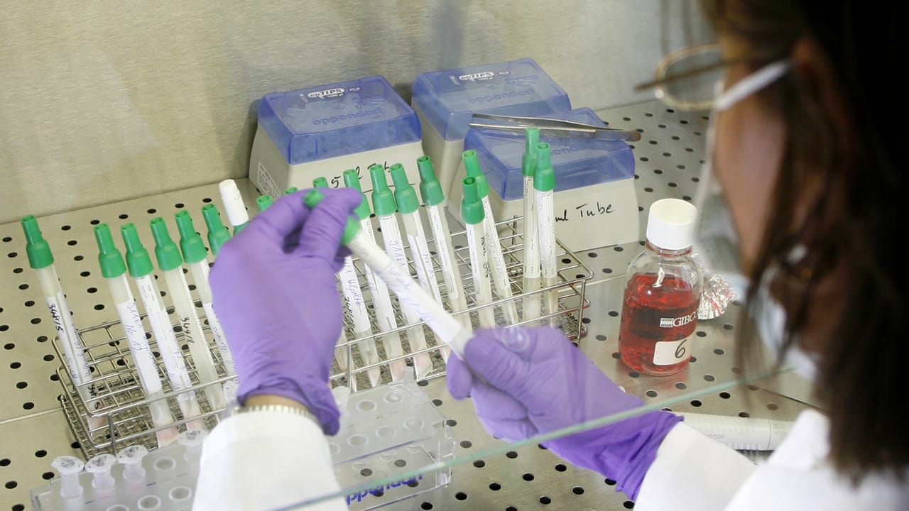 Genetische Untersuchungen - «Natürlich ist es ein Eingriff in die ...