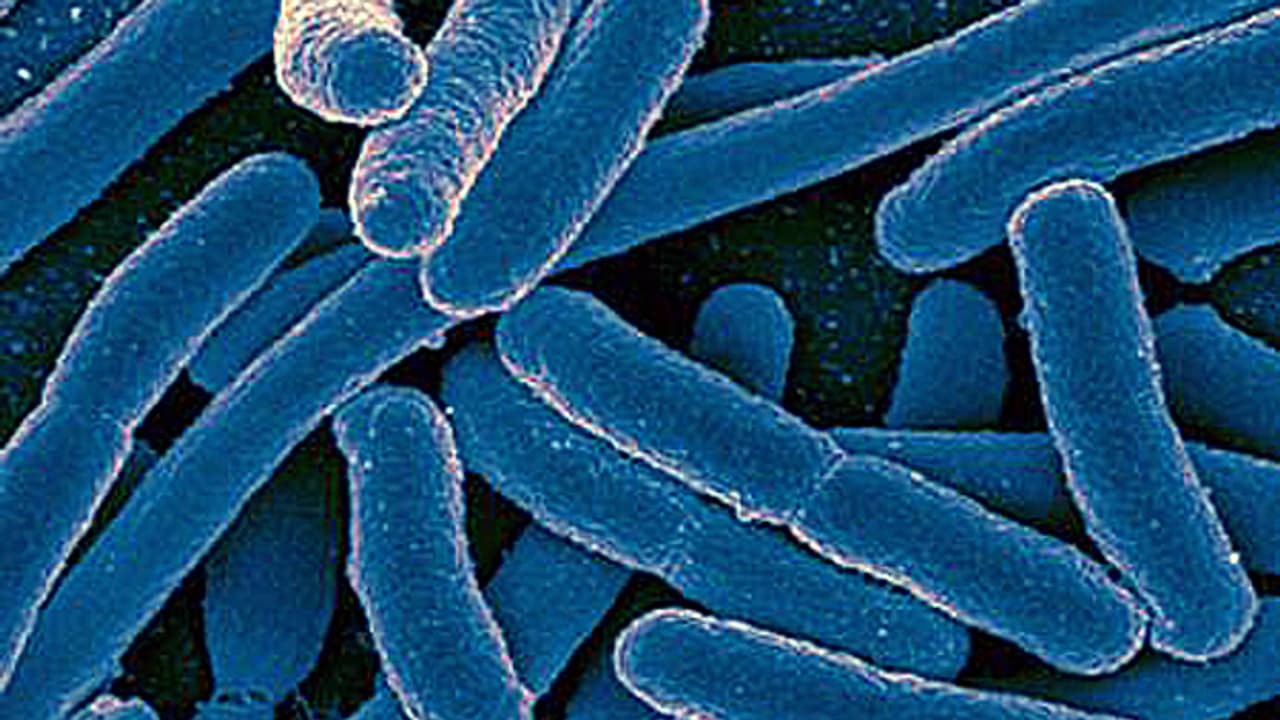 Ostschweiz Legionellen im Wasser Fünf St.Galler Hotels beanstandet