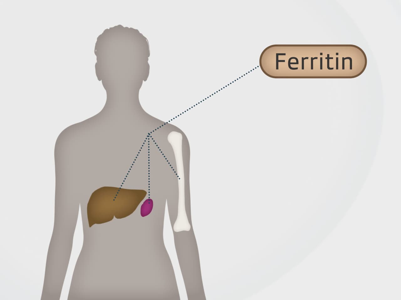 Infusionen mit Eisen Wie viel Eisen darf es sein? Wissen SRF