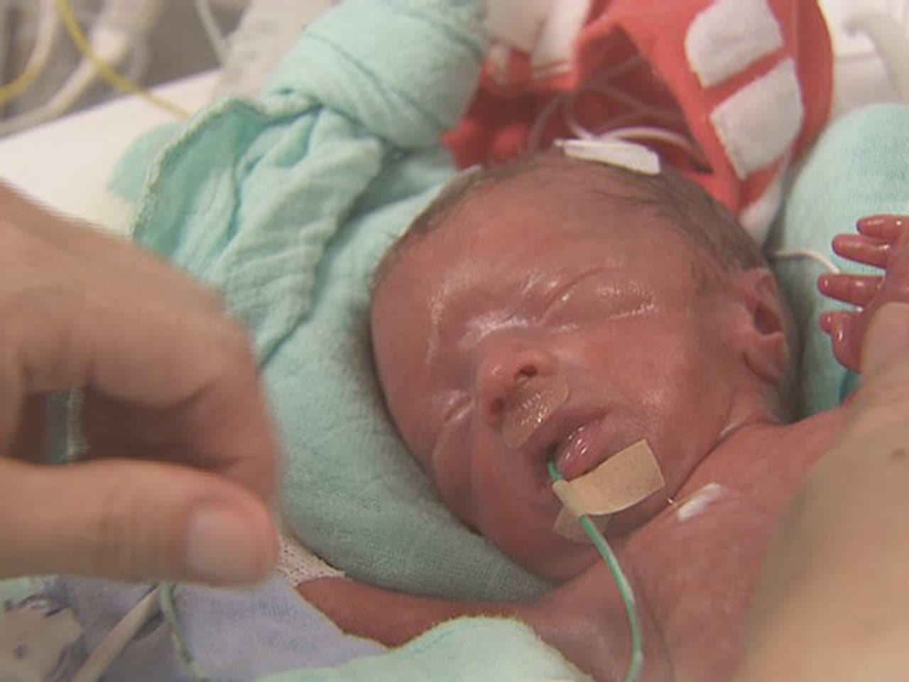 Frühe Frühchen (1) Drei Monate vor Termin Doppelter Frühstart ins Leben Wissen SRF Frühe Frühchen (1) Drei Monate vor Termin Doppelter Frühstart ins Leben Wissen SRF