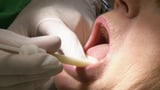 Mundhälfte nach Zahnarzt-Pfusch taub (Artikel enthält Video)