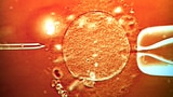 Gen-Tests an In-Vitro-Embryonen ­– darum geht es (Artikel enthält Video)