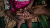 400'000 Menschen in Tigray akut vom Hungertod bedroht (Artikel enthält Video)