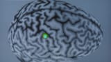 Video «Gehirndoping: Wie wir schlauer werden» abspielen