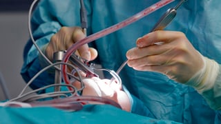 Ein Arzt führt am Kopf einer Patientin eine Operation durch. Ein Arzt führt am Kopf einer Patientin eine Operation durch.