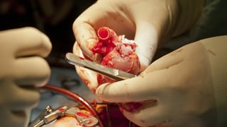 Die Hände eines Chirurgen oder einer Chirurgin halten ein Herz.