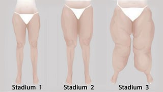 3 Stadien 3 Stadien