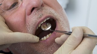 Zahnarztspiegel in Mund von Mann mit weissem Bart. 