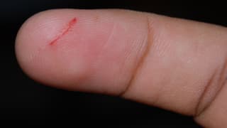 Eine Fingerkuppe mit einer blutenden Papierschnittwunde