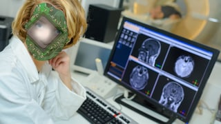 Ein Bildschirm mit Scans eines omputertomographen, davor eine Ärztin, die die Bilder analysiert, wobei ihr Kopf mit einem Computerchip vermischt ist. 