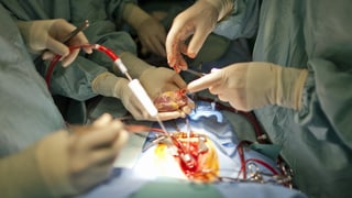 Kinderchirurg Rene Prètre implantiert einem Kleinkind ein neues Herz. (keystone) 