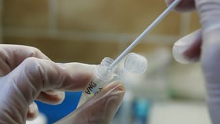 Pipette und Gummihandschueh