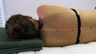 Frau liegt mit dem Rücken zum Betrachter. Punkte auf ihrer Wirbelsäule bilden eine gerade Linie, illustriert von einem Laserstrahl.