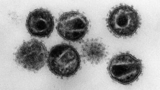 HI-Virus unter dem Mikroskop HI-Virus unter dem Mikroskop