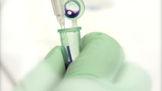 Pipette und Handschuh.
