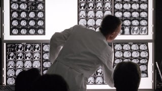 Ein Arzt vor einer Wand mit Röntgen-Bildern vom Gehirn.