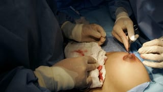 Immer mehr Frauen wünschen sich zu Weihnachten grössere Brüste.