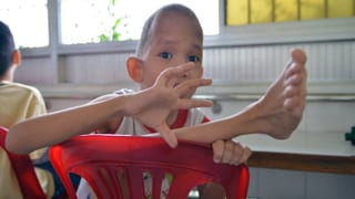 Kind mit dünnen, verbogen-steifen Gliedern, das in einem roten Plastikstuhl sitzt.