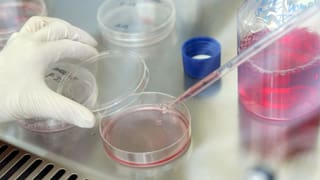 Symbolbild Pipette und farbige Flüssigkeiten in verschiedenen Gefässen Symbolbild Pipette und farbige Flüssigkeiten in verschiedenen Gefässen