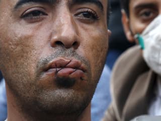 Ein Iraner hat sich an der griechisch-mazedonischen Grenze den Mund zugenäht. (reuters)