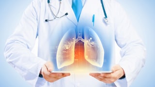 Grafik eines Arztes mit einem 3-D-Lungenmodell.
