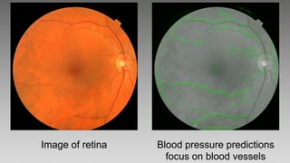 Zwei Bilder der Menschlichen Retina. Zwei Bilder der Menschlichen Retina.
