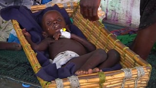 Ein unterernährtes Kind erhält Hilfe von den Médecins Sans Frontières in Südsudan.