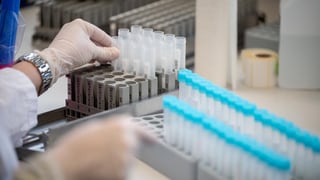 «PCR-Test wird nicht bezahlt, weil in Österreich ausgewertet» auf einer neuen Seite abspielen.