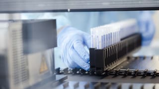 «Labor-Verband fordert Priorisierung bei PCR-Tests» auf einer neuen Seite abspielen.