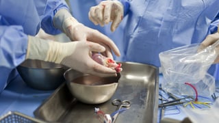 «US-Ärzte transplantieren genmanipuliertes Schweineherz» auf einer neuen Seite abspielen.