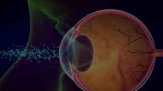 «Gentherapie gegen seltene Augenkrankheit» auf einer neuen Seite abspielen.
