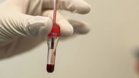 Hand mit Blut-Pipette.