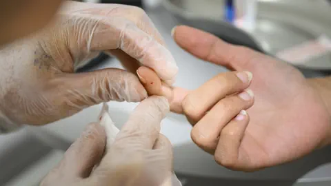 Eine Blutzuckermessung