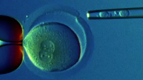 Polkörperbiopsie: Links die Haltepipette, mit der die Eizelle durch einen leichten Unterdruck fixiert wird und rechts die Biopsiepipette, mit der die Polkörper nach Eröffnung der Eizellenhülle entnommen werden.
