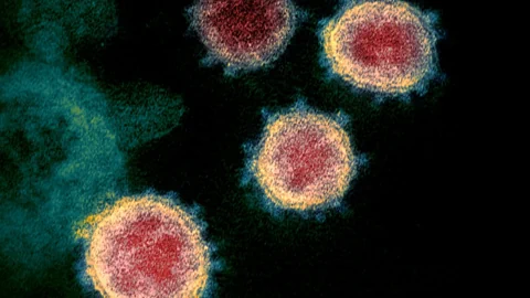 Elektronenmikroskop-Aufnahme des Coronavirus.