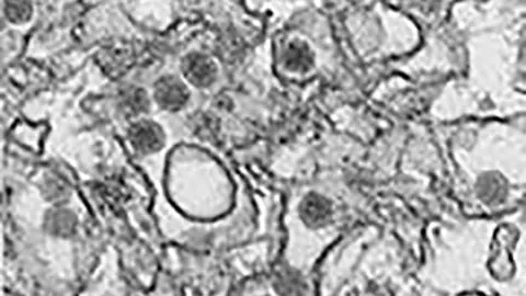 Zika-Virus aus Brasilien