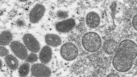 Affenpocken-Virus durch das Mikroskop.