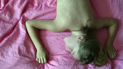 Oberkörper einer Person mit Hautausschlag auf rosa Bettlaken.